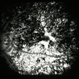 Rubella Retinopathy